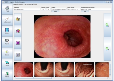 Ocram Captura de Imagens Médicas e Laudos