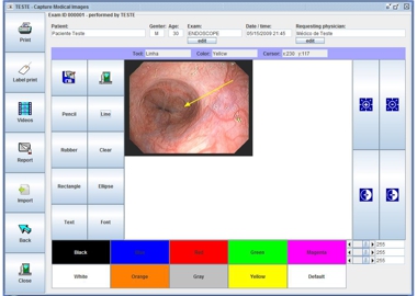 Ocram Captura de Imagens Médicas e Laudos